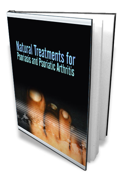 Natural Treatments for Psoriasis - Predicting My Future